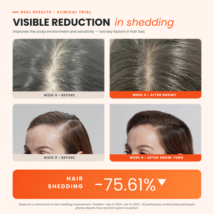 Growy™ Hair Growth Serum (All-In-One)